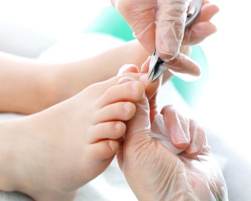 Read more about the article Pincer nail surgery