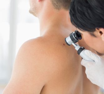Mole-check-and-skin-cancer-screening